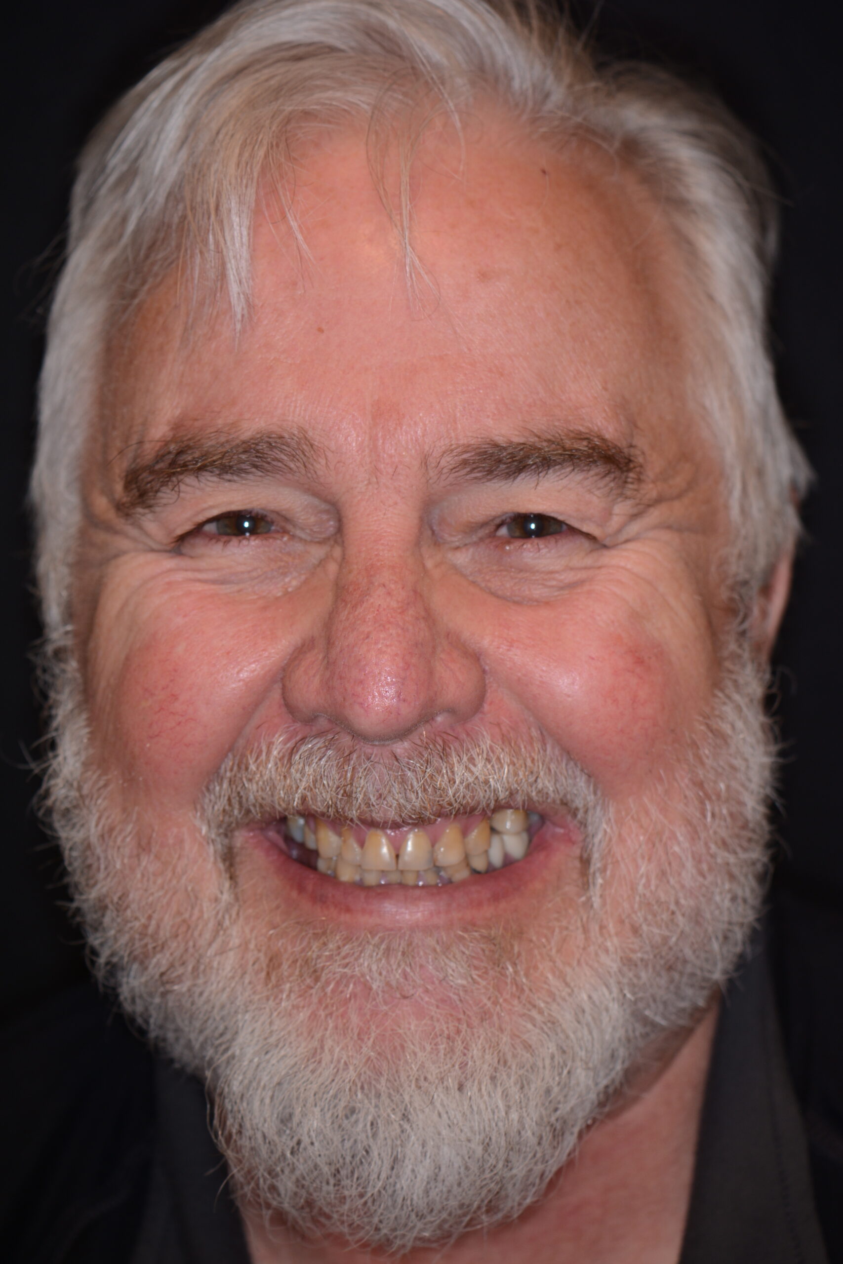 Mark before treatment